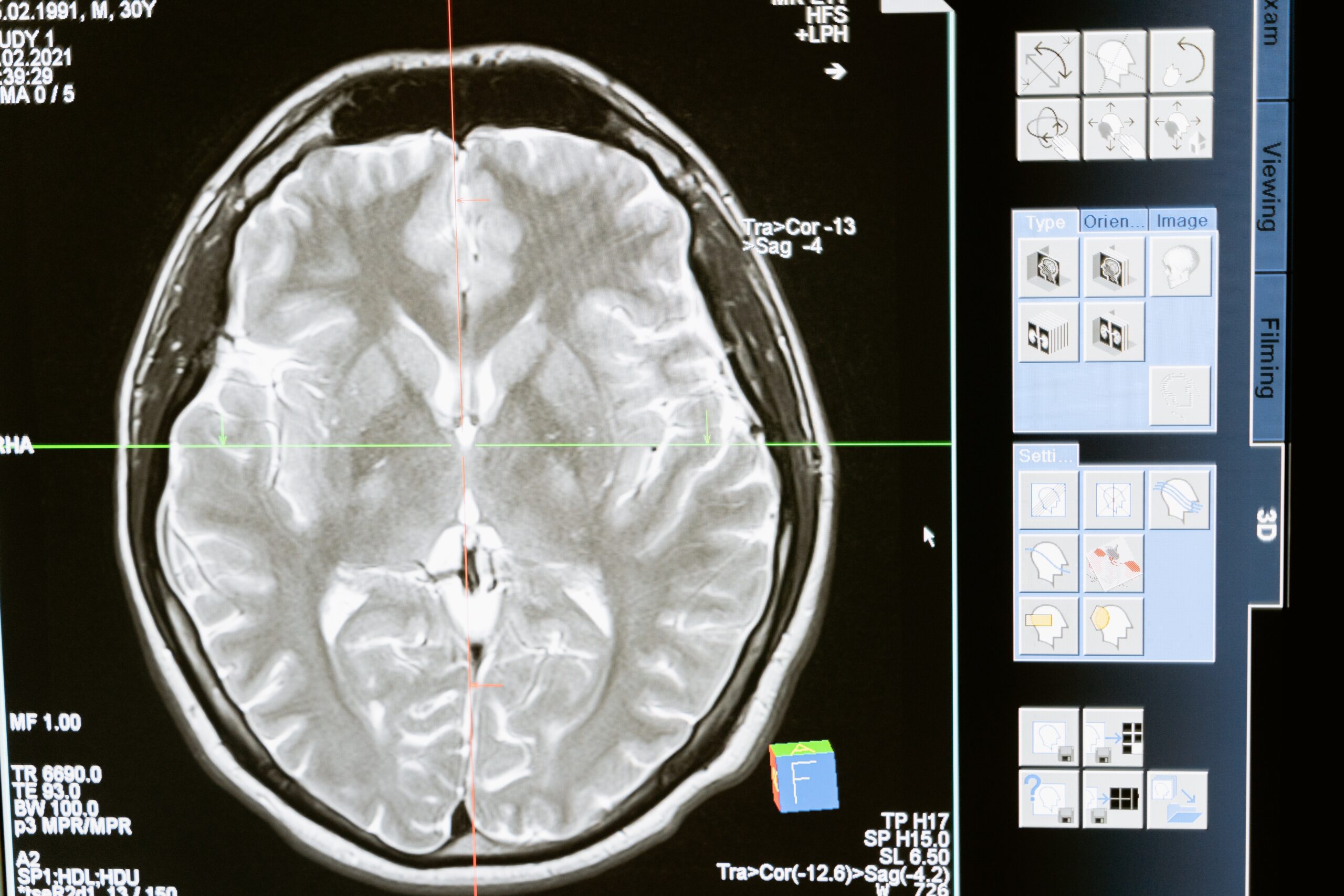 I batteri intestinali influenzano lo sviluppo del cervello